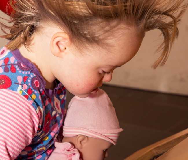 down syndrom 5956423 1280