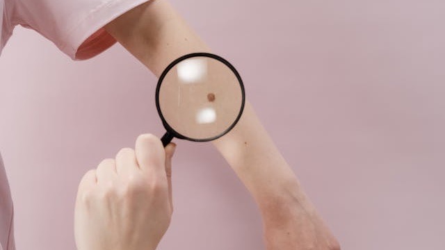neo dermatologia
